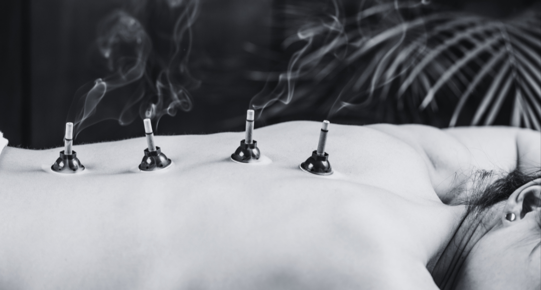 Moxibustion