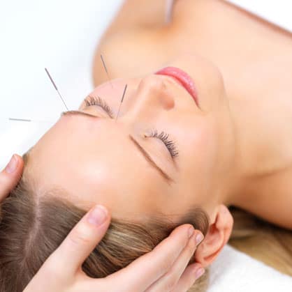 Facial acupuncture