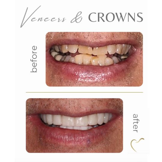 Cosmetic dentistry Atlanta