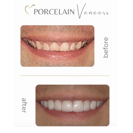 Dental treatment Atlanta Smiles