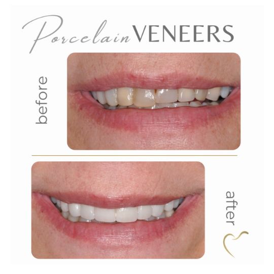 Patient smile results