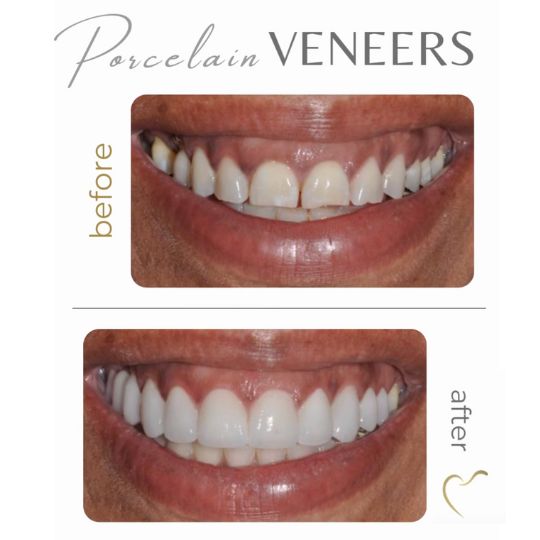 Atlanta Smiles dental office