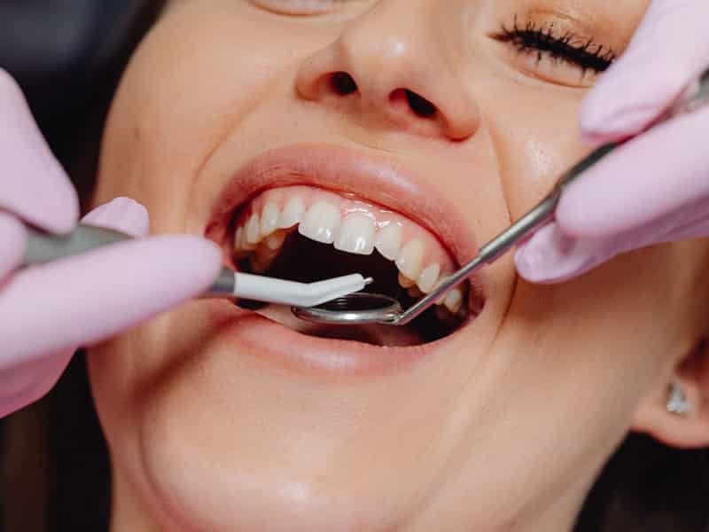 Professional teeth cleaning at Atlantic Dental