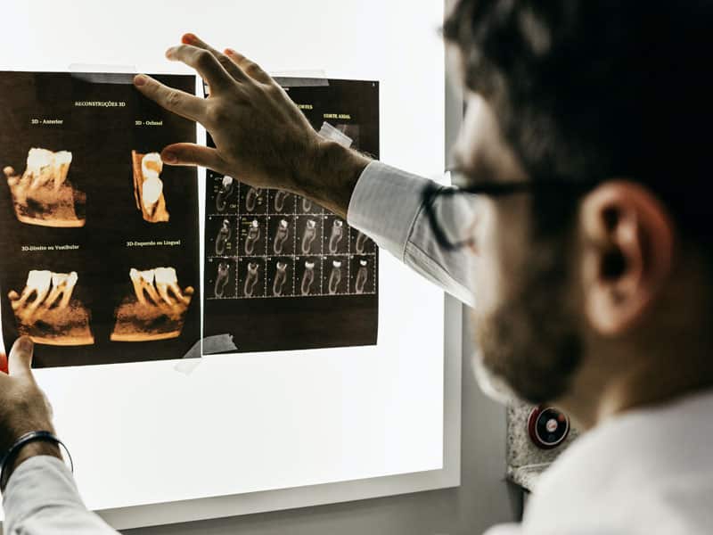 Wisdom teeth removal service