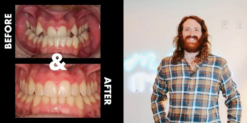 Patient with Before & After Photo