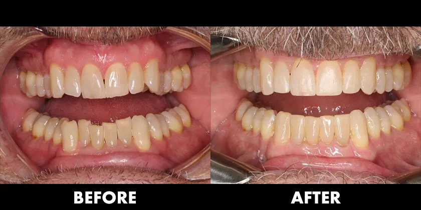 Before & After Treatment