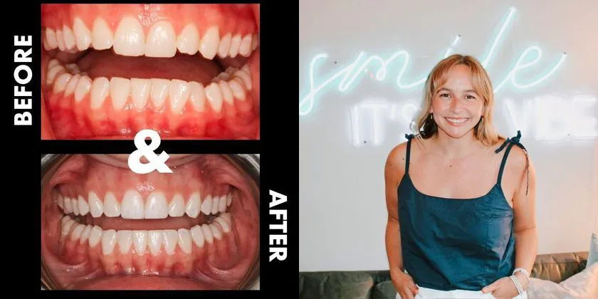 Patient with Before & After