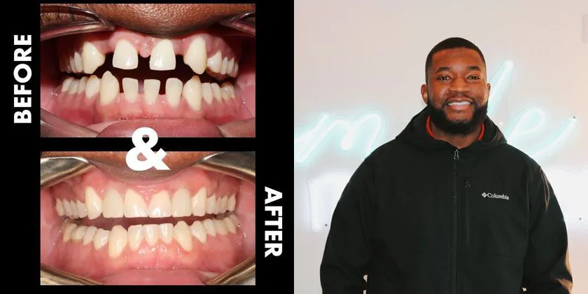 Patient with Before & After Photo