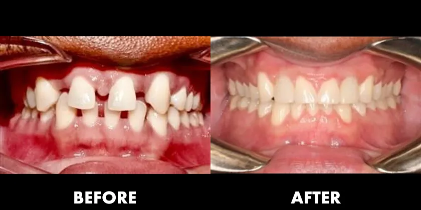 Before & After Treatment