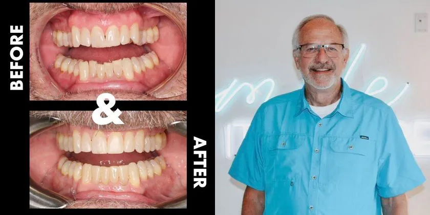 Patient with Before & After
