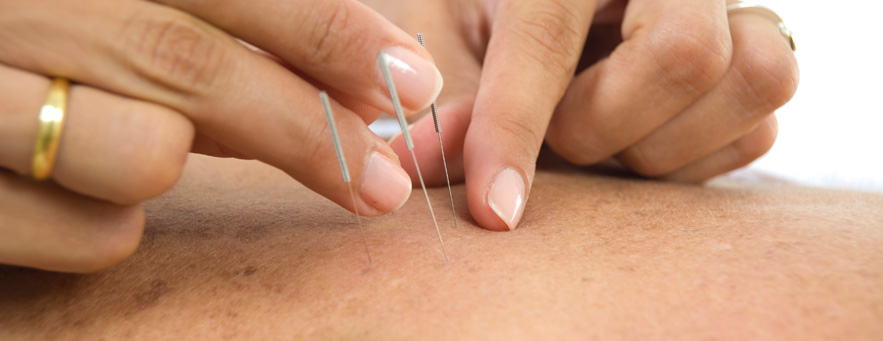 Five Element Acupuncture