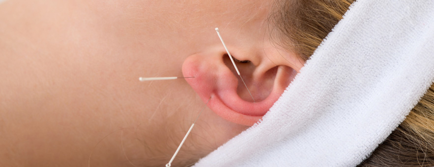 Harmonizing Acupuncture