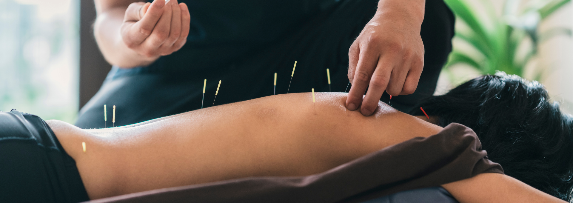 Eastern Acupuncture and Wellness team