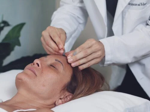 Acupuncture near Plantation FL