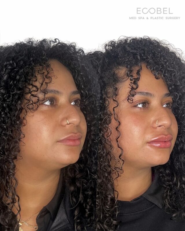 Ecobel Valentine's Day