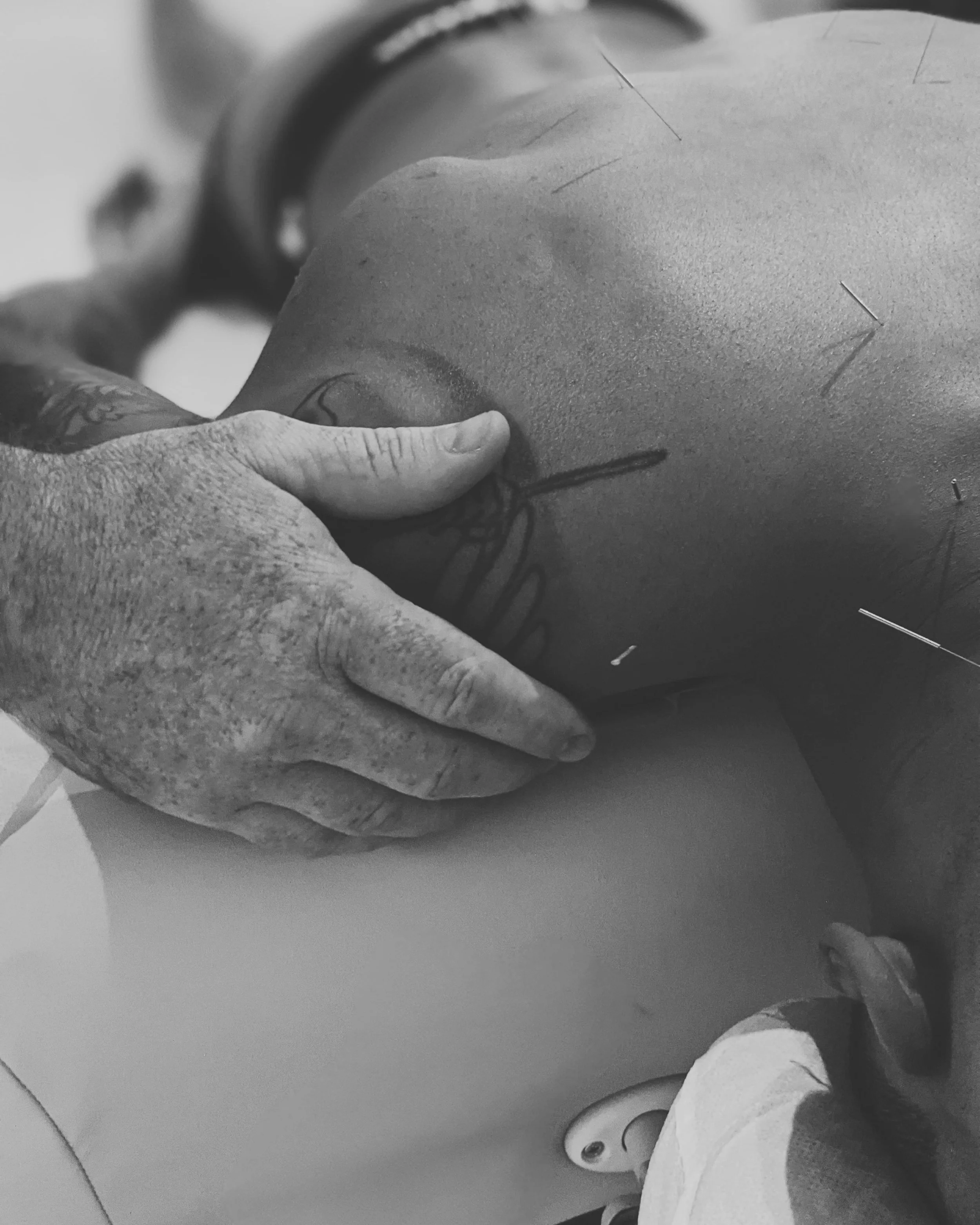 patient on acupuncture table with empathetic healing touch from acupuncturist