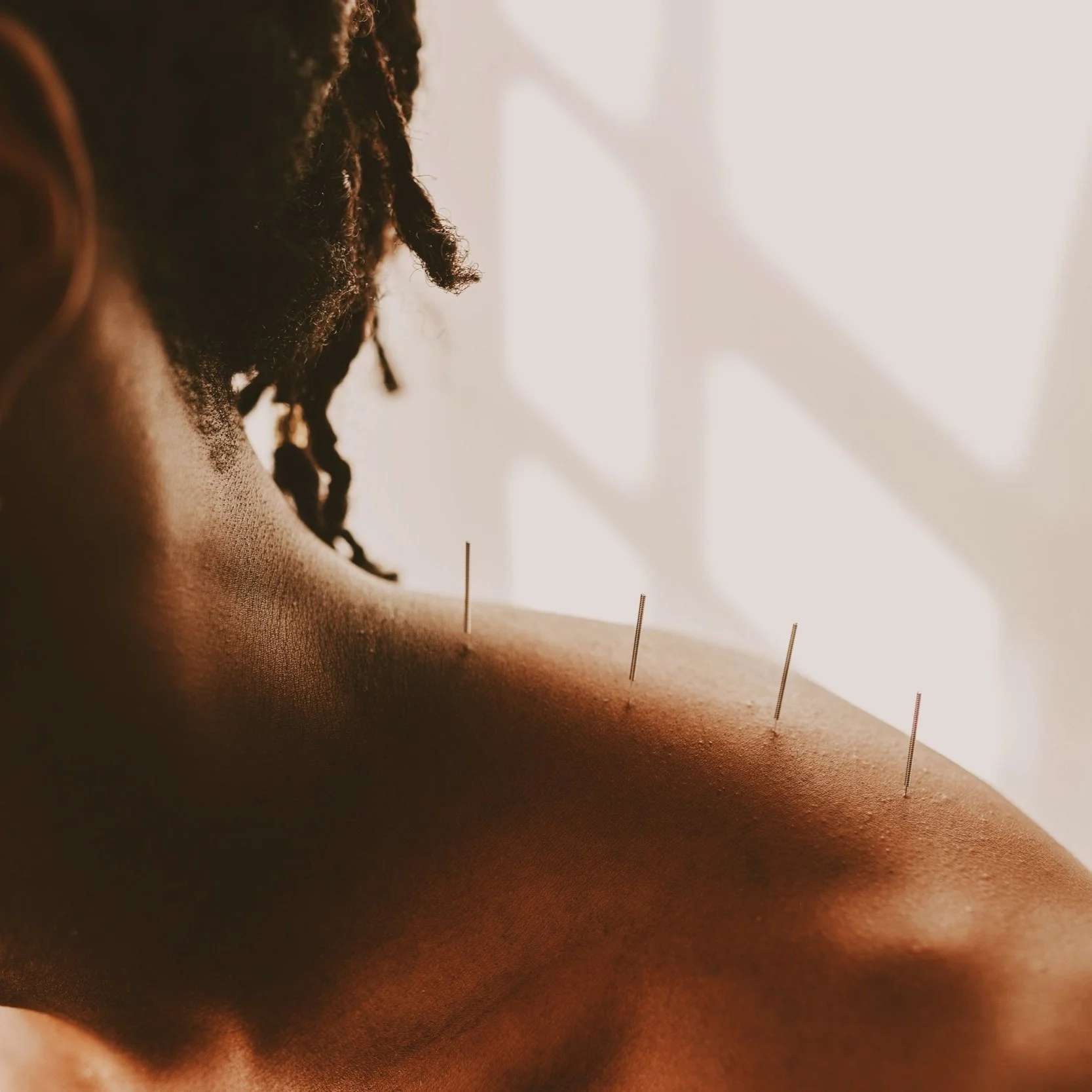 Scottsdale Acupuncture Chi