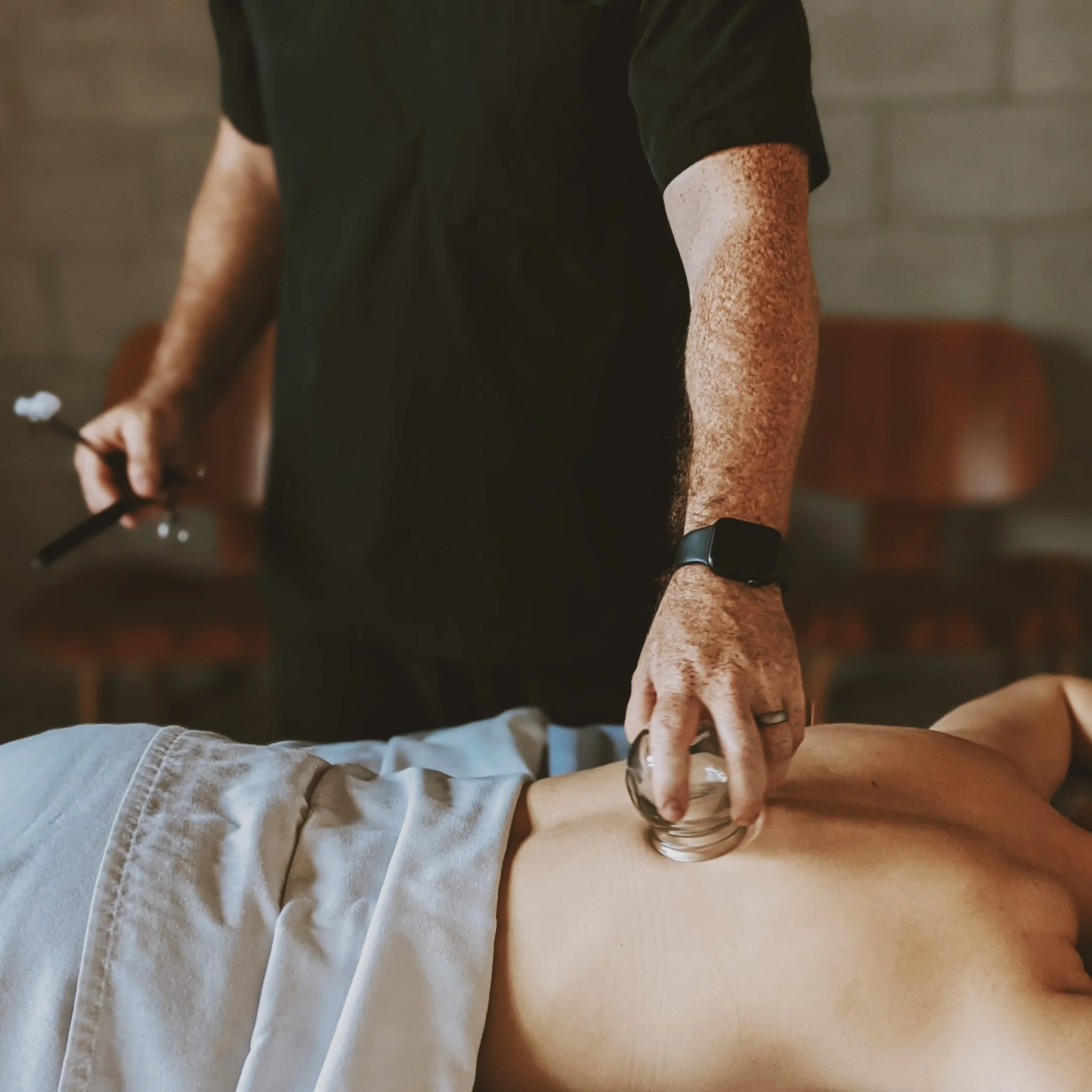 An acupuncture patient receives cupping treatment
