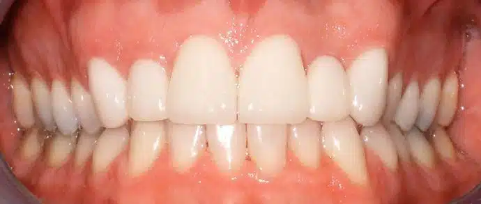 Dental transformation result