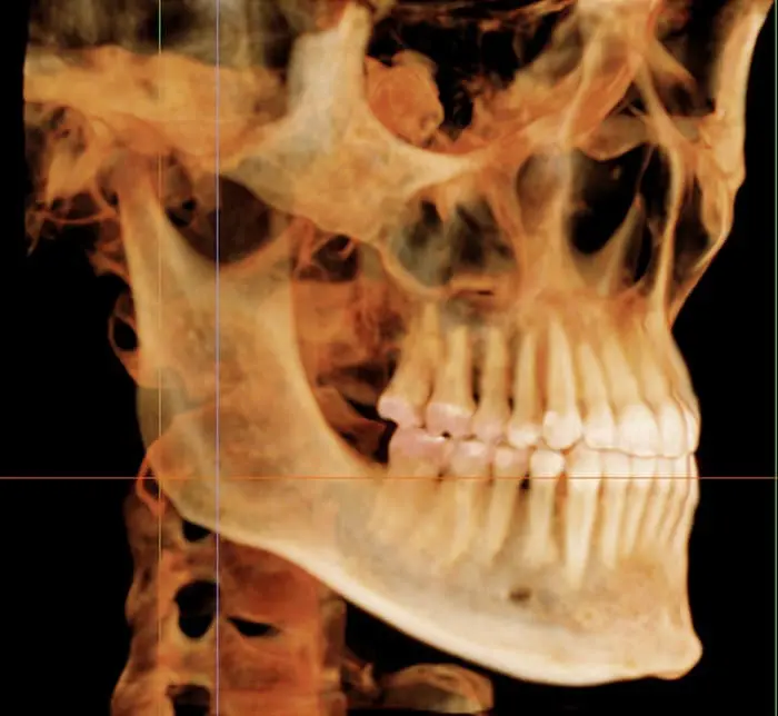 Advanced 3D CT scan technology at Limestone Hills Orthodontics Austin