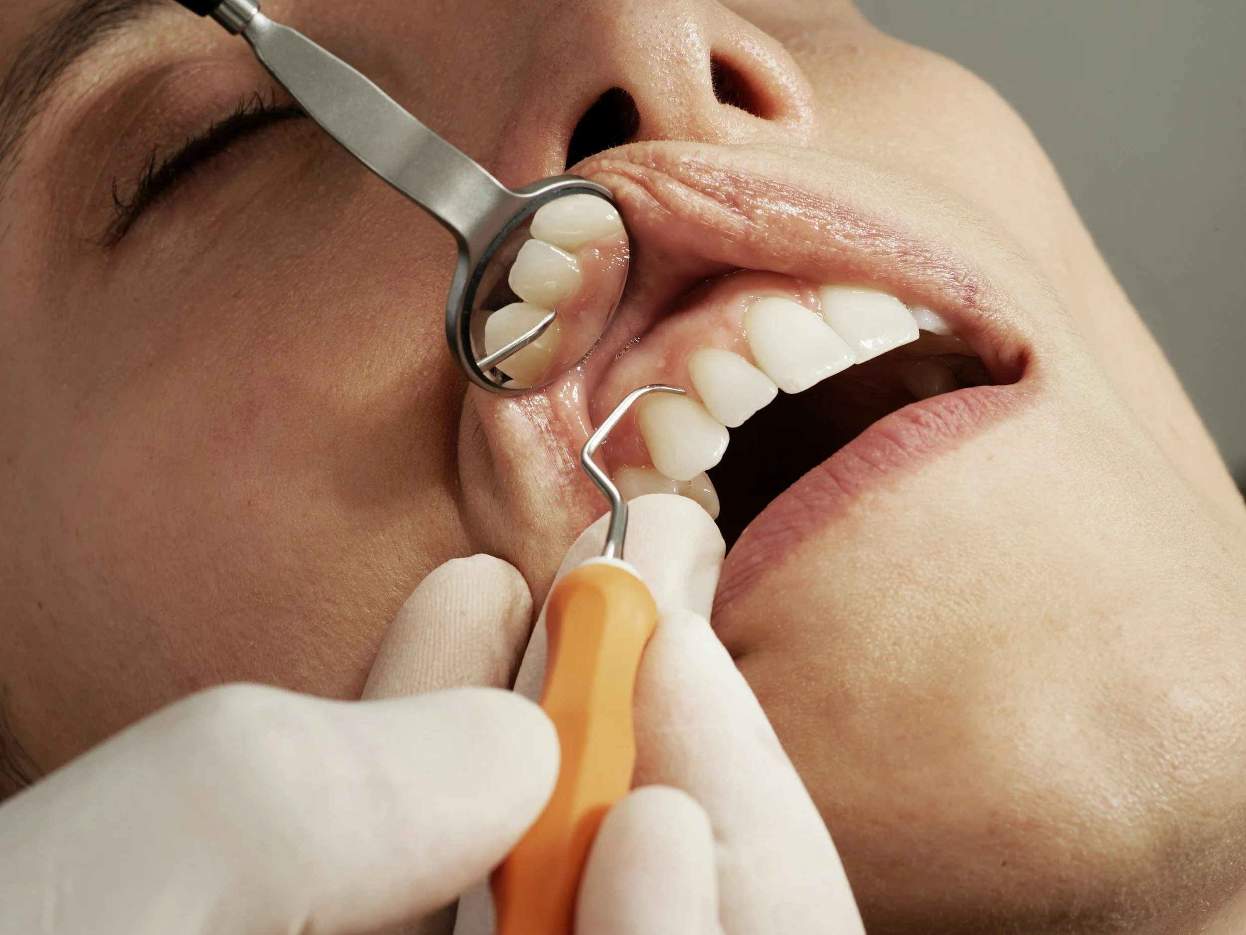 Patient receiving dental care at Newport Beach Dental Associates