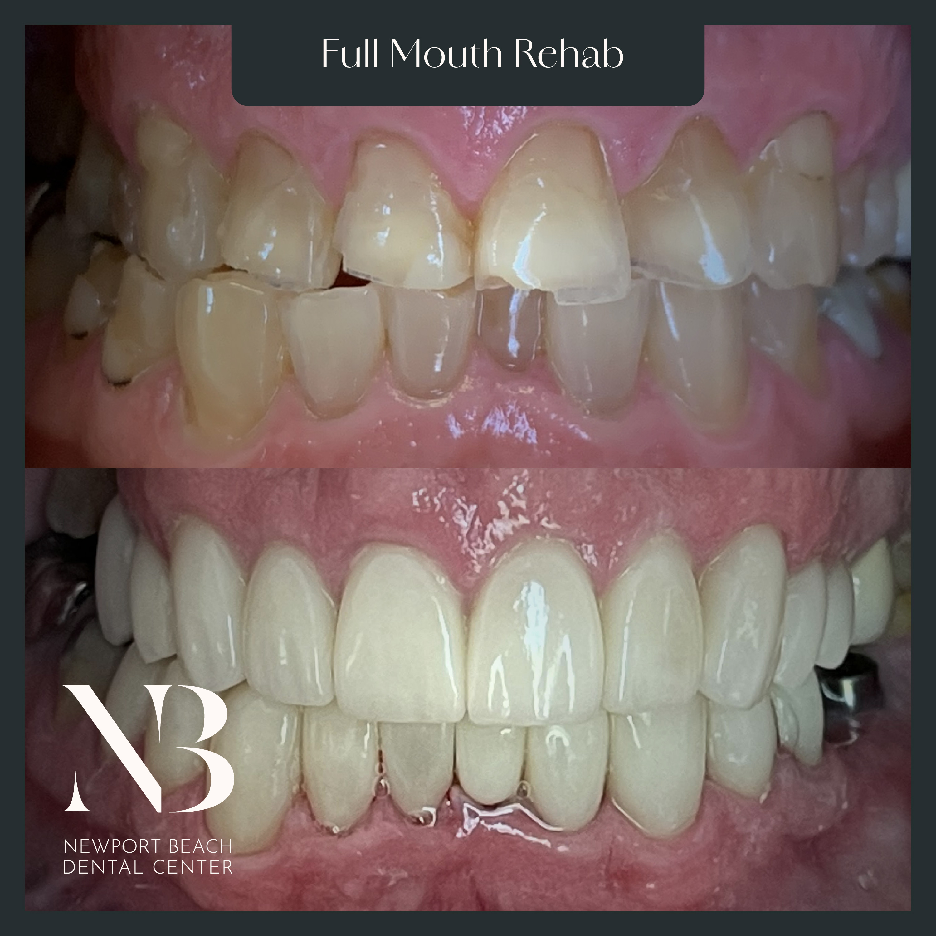 Dental care at Newport Beach Dental Center