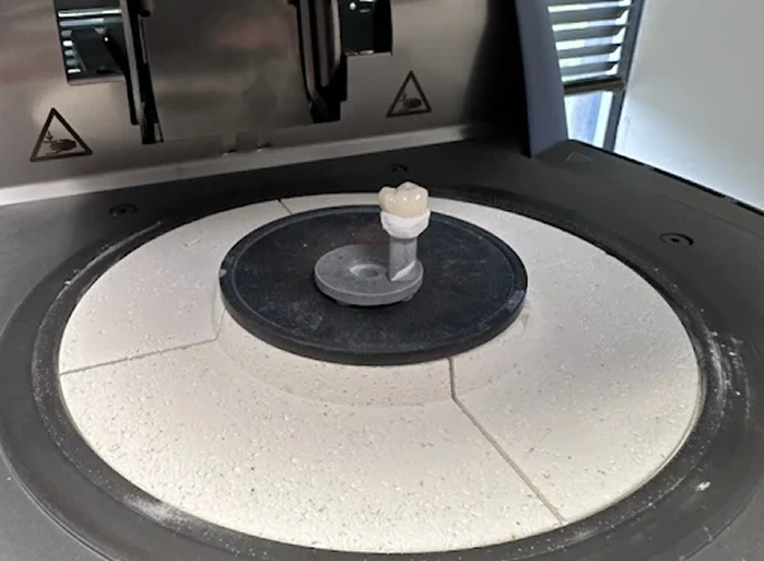 Restorative dental technology