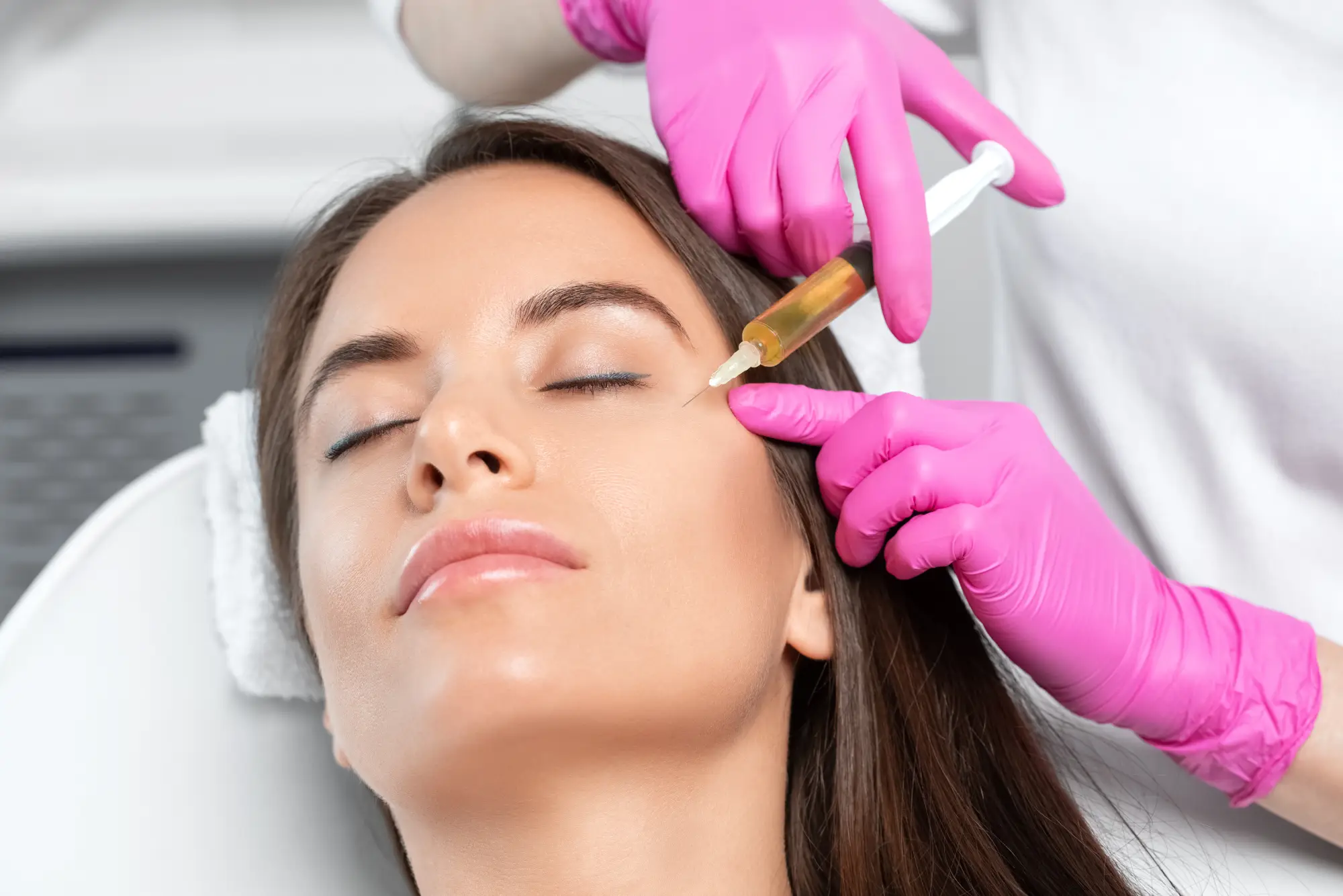 Dermal Fillers and Sculptra Scottsdale