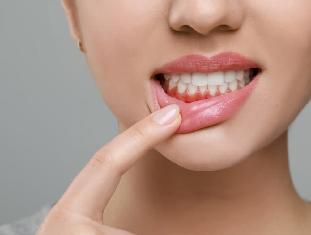 Healthy white teeth