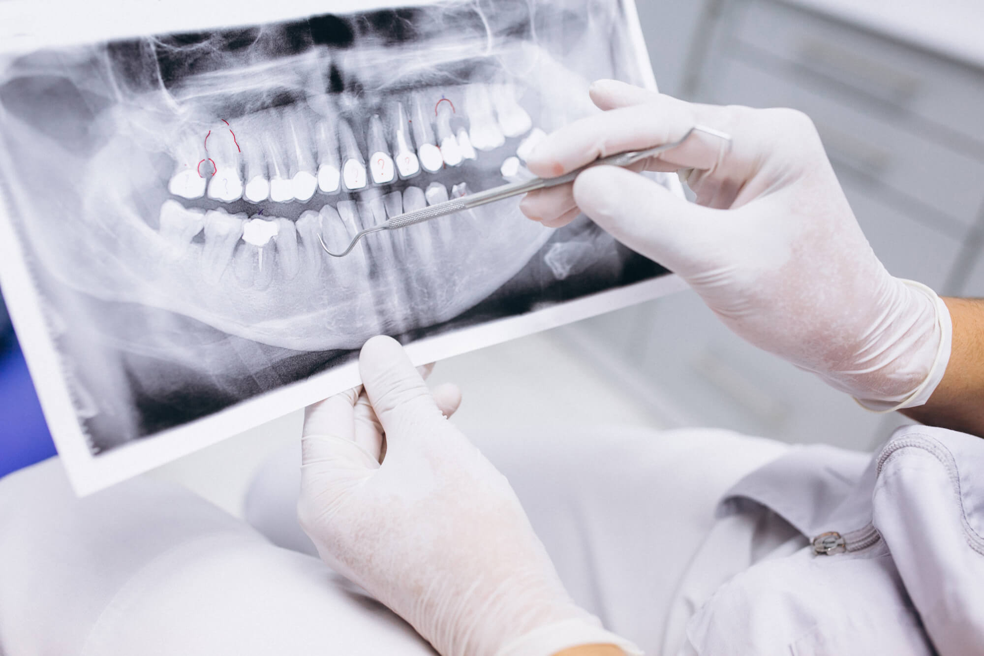 Teeth X-ray