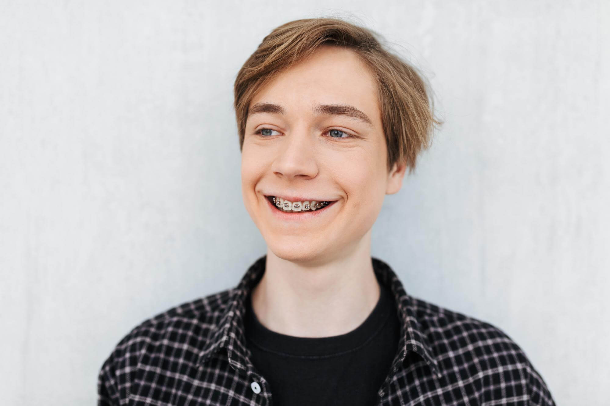 Orthodontic braces treatment